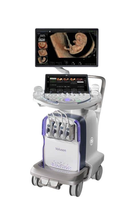 4D Ultrasound
